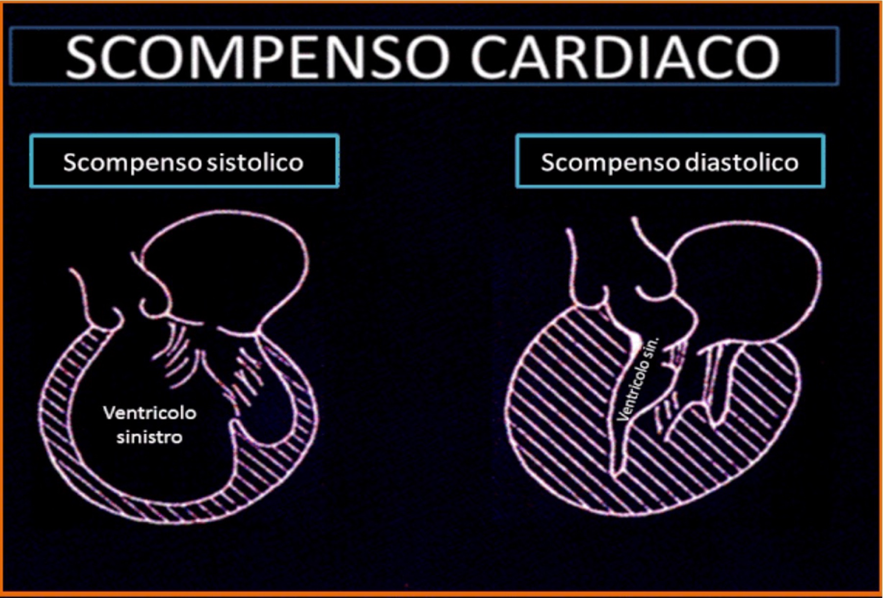 Scompenso cardiaco — Dott. Alessandro Blandino